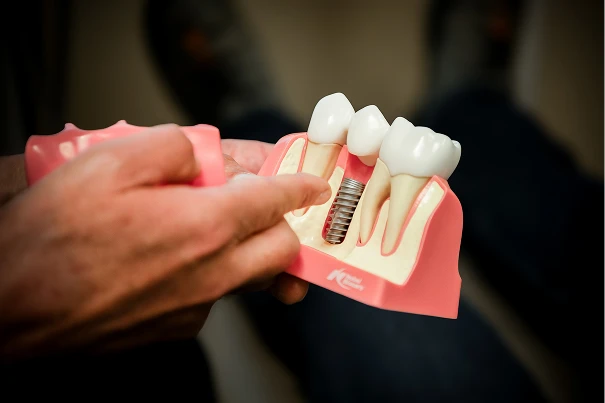 A model of teeth