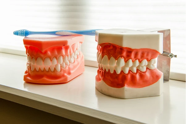 A few models of teeth